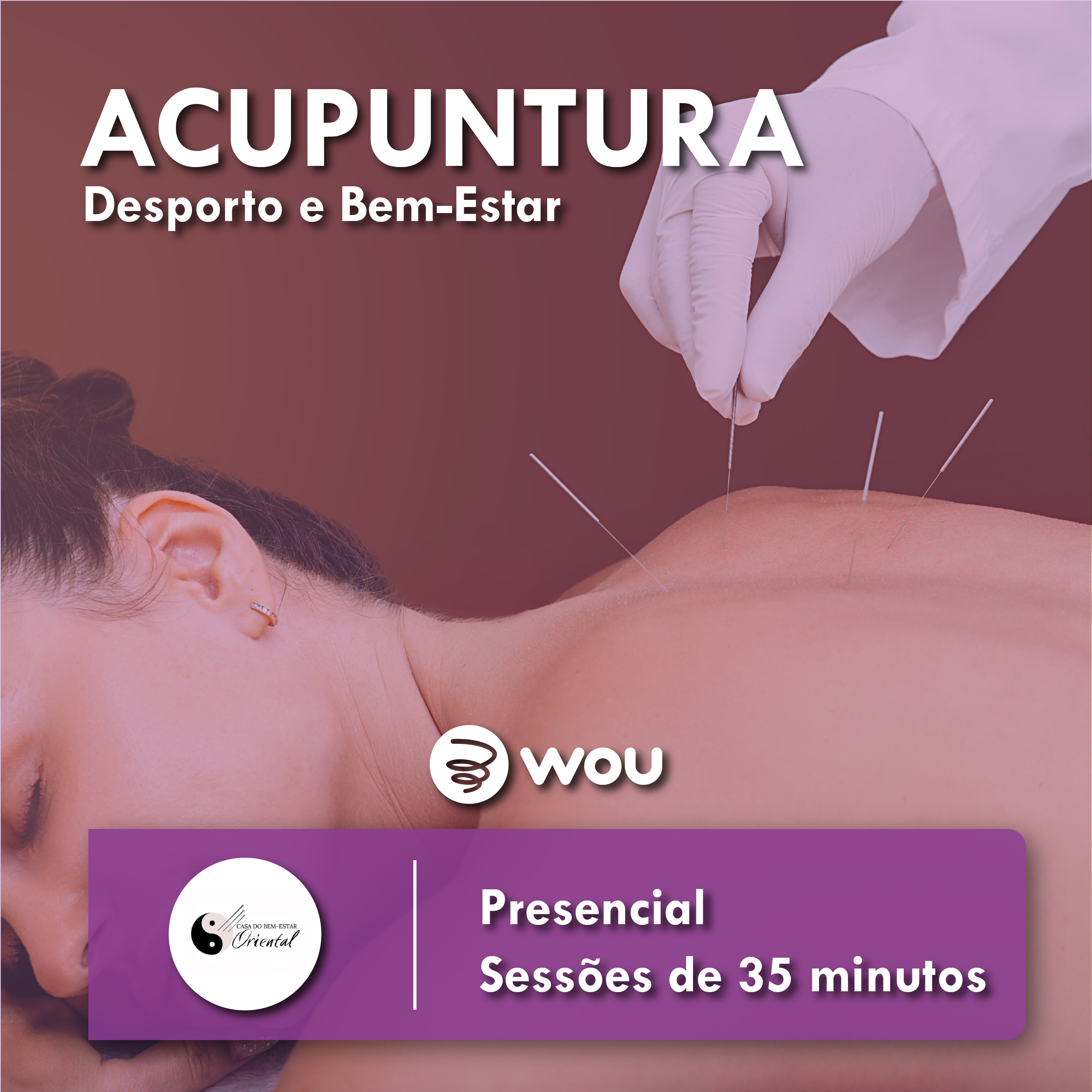 Acupuncture in Coimbra