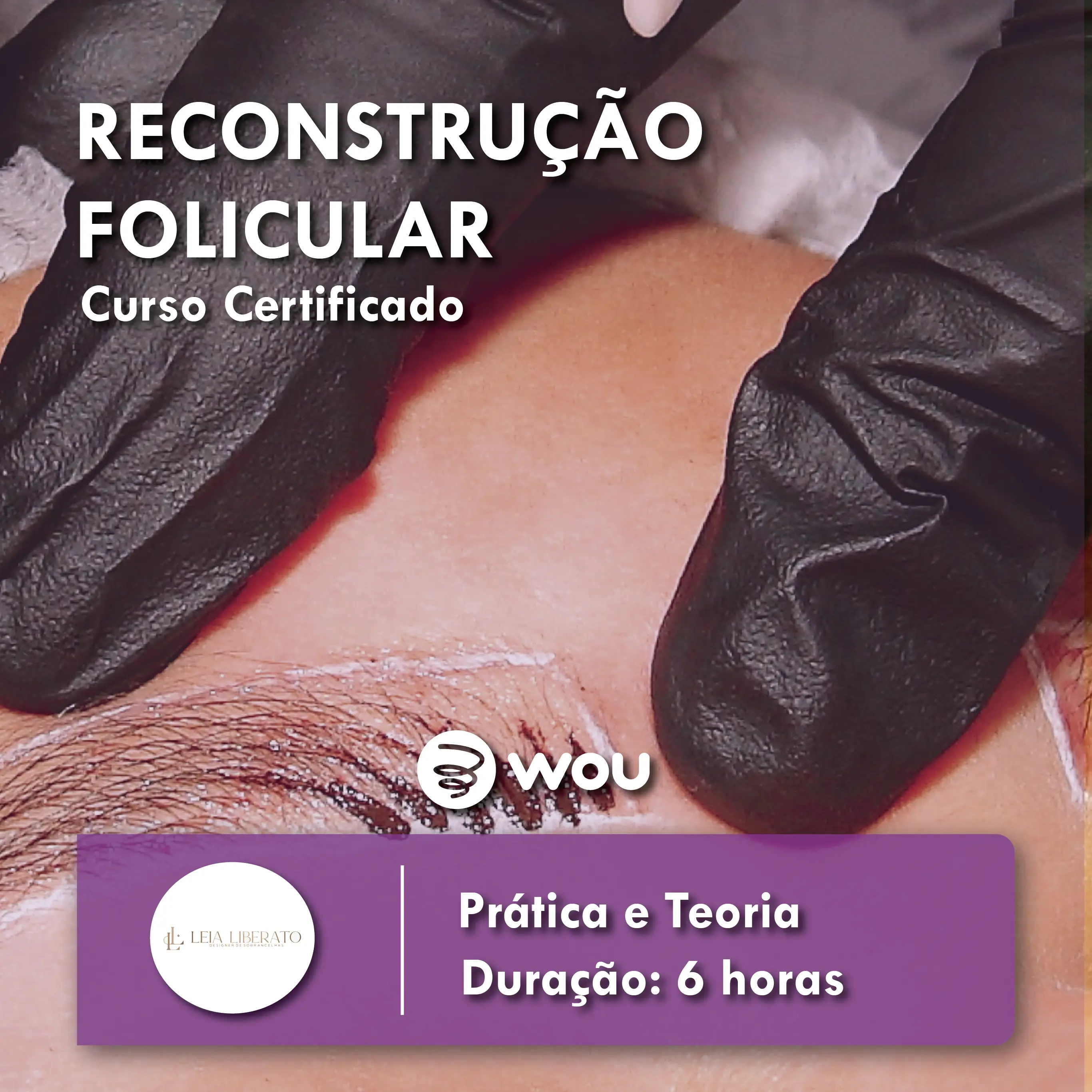 Curso de Reconstrução Folicular no Porto